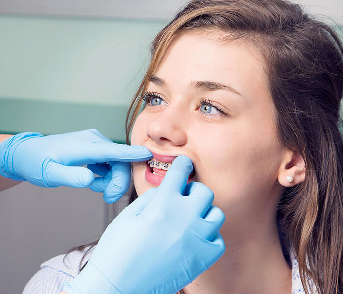 Waarom zet de orthodontist niet alleen de voortanden recht?