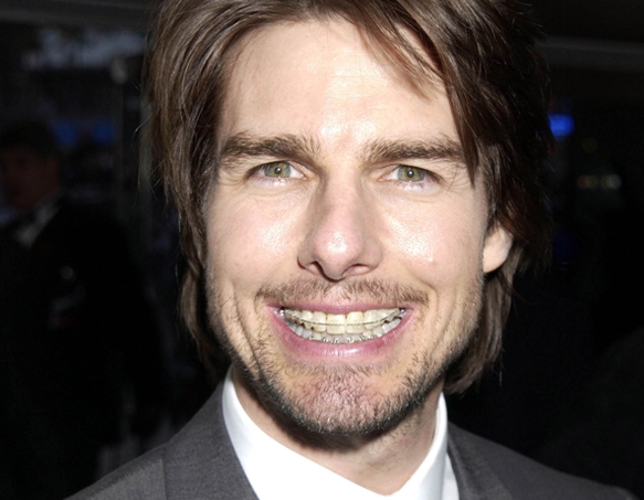 Tom Cruise met een beugel